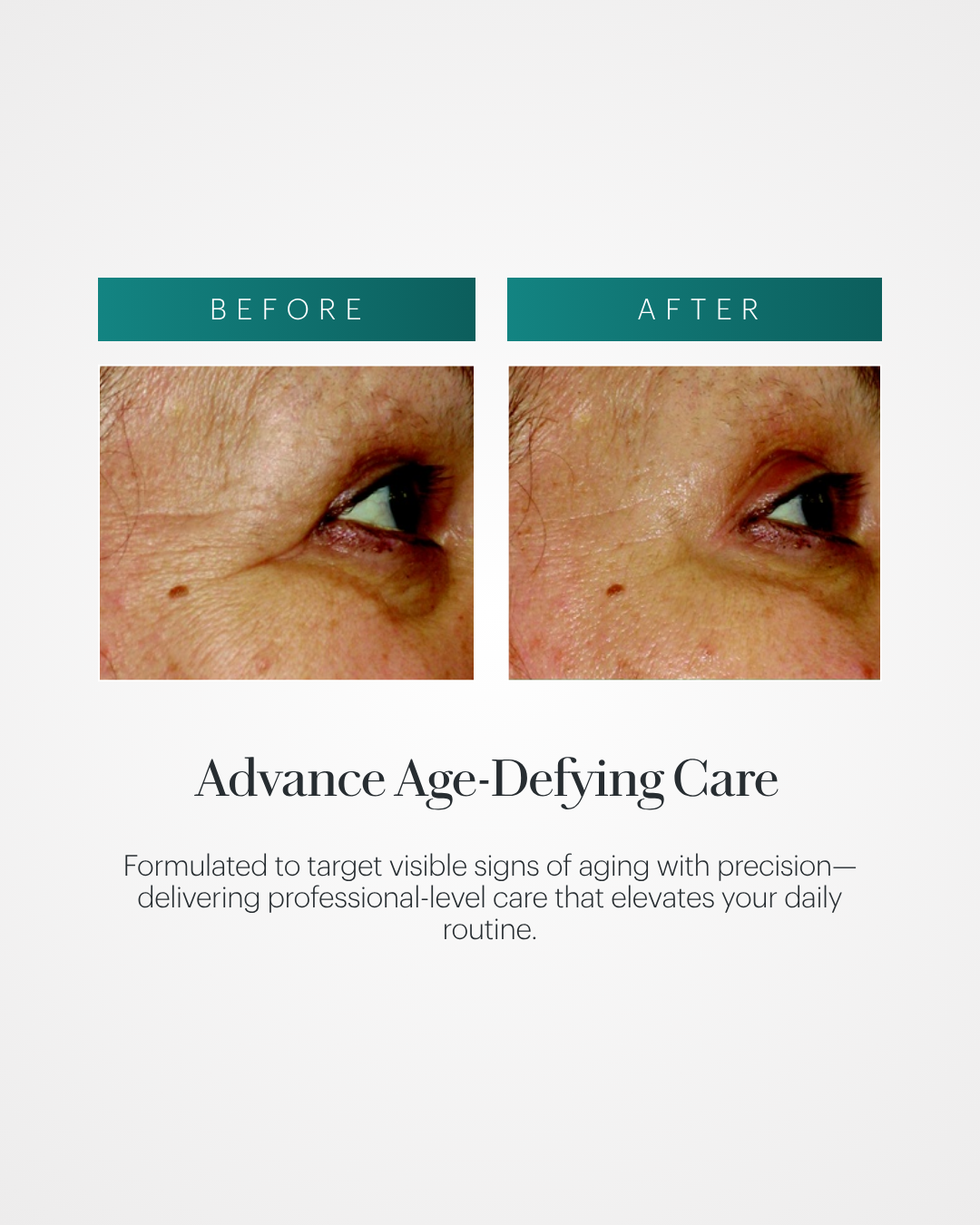 Vita Cura® Opti-Lift® Serum