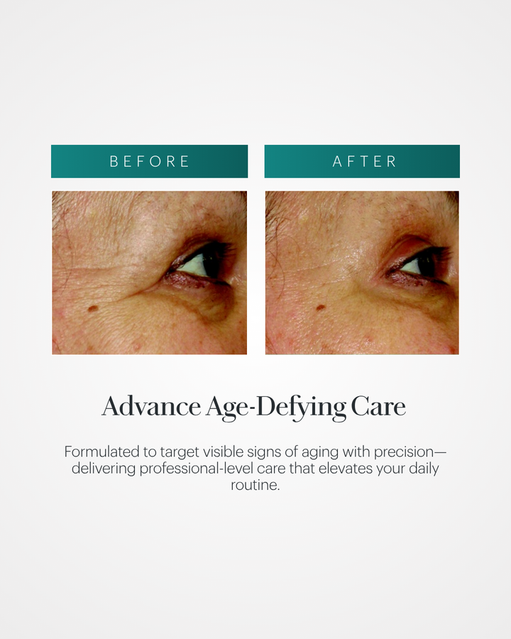 Vita Cura® Opti-Lift® Serum