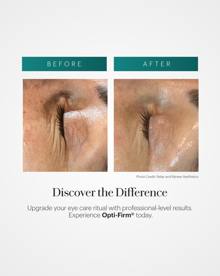 Opti-Firm® Eye Contour Cream - On Sale